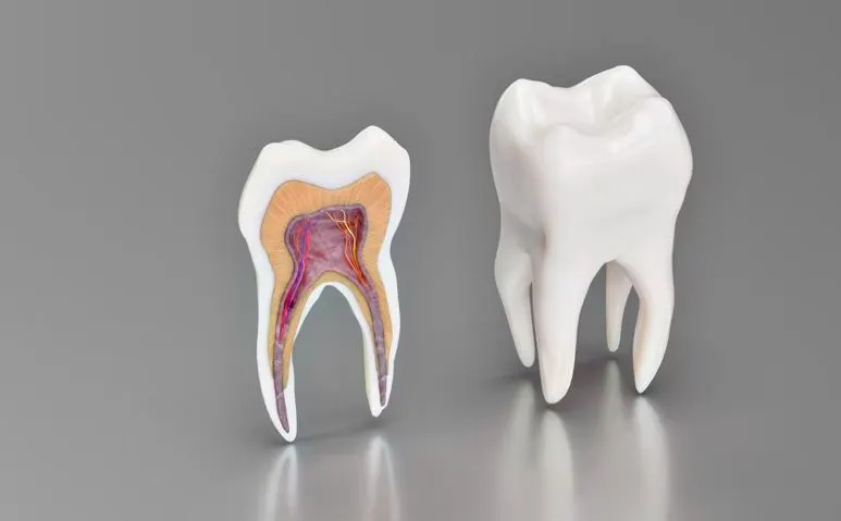A detailed medical model of wisdom tooth anatomy