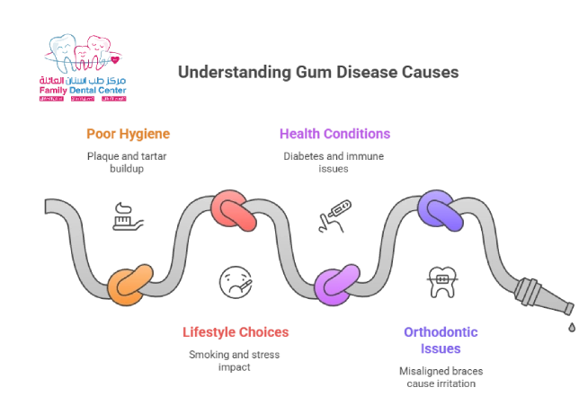Common Causes of Gum Disease 
