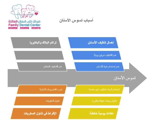 أسباب تسوس الأسنان