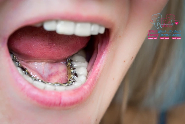 التقويم الداخلي للاسنان