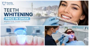 Teeth Whitening Price in Oman at a professional dental clinic