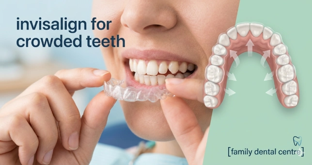 Invisalign for Crowded Teeth